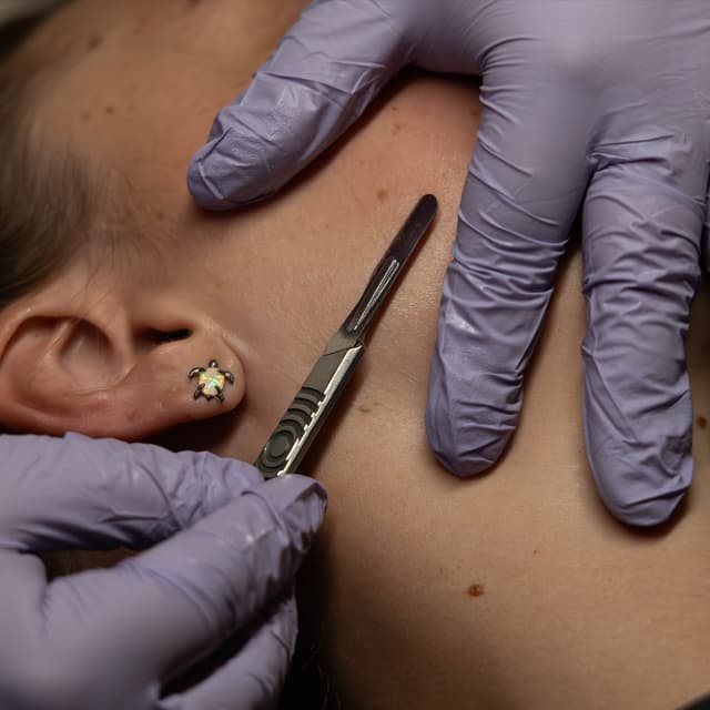 Dermaplane Series (90 Minute) at Cedar & Sage Spa in Bolivar, MO